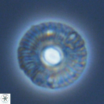 Calcidiscus tropicus VR 09922
