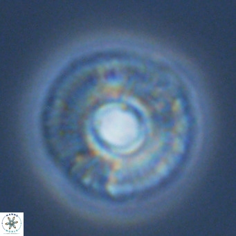 Calcidiscus tropicus VR 09923