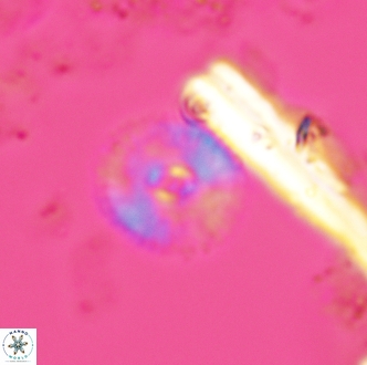 Calcidiscus bicircus 1994