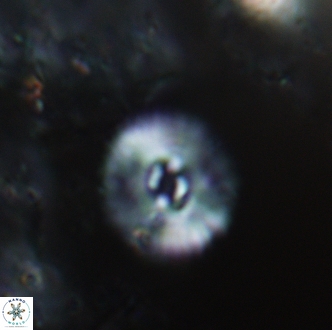 Calcidiscus bicircus 1995