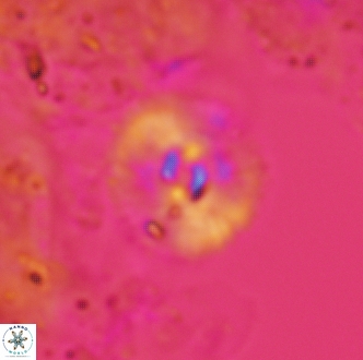 Calcidiscus bicircus 1996
