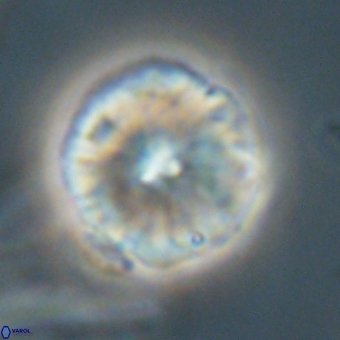 Calcidiscus cf pacificanus 68052