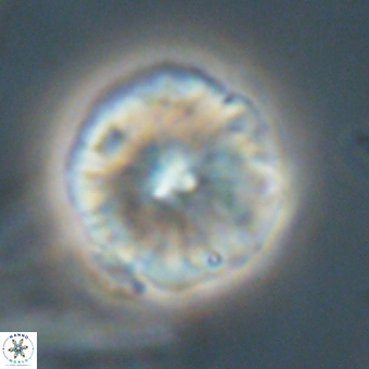 Calcidiscus cf pacificanus 68052