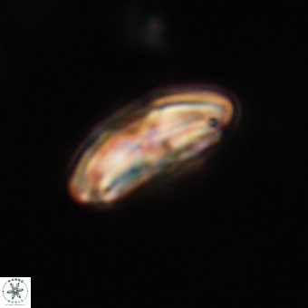 Calcidiscus cf pacificanus 68066