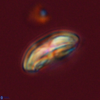 Calcidiscus cf pacificanus 68067