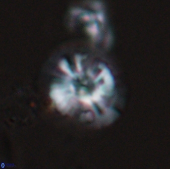 Calcidiscus cf pacificanus Unknown 00004