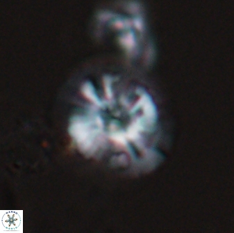 Calcidiscus cf pacificanus Unknown 00004