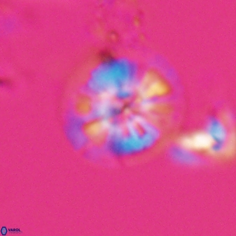 Calcidiscus cf pacificanus Unknown 00006