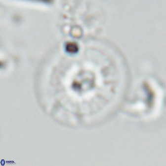 Calcidiscus cf pacificanus Unknown 00007