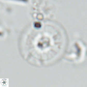 Calcidiscus cf pacificanus Unknown 00007