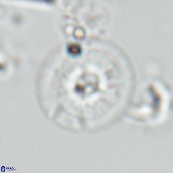 Calcidiscus cf pacificanus Unknown 00008