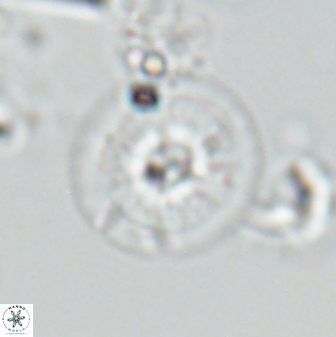Calcidiscus cf pacificanus Unknown 00008