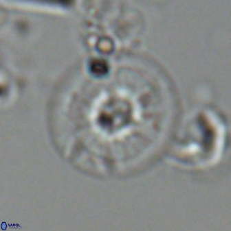 Calcidiscus cf pacificanus Unknown 00009