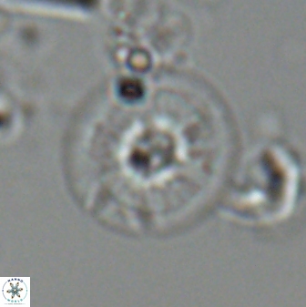 Calcidiscus cf pacificanus Unknown 00009