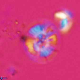 Calcidiscus cf pacificanus Unknown 00002