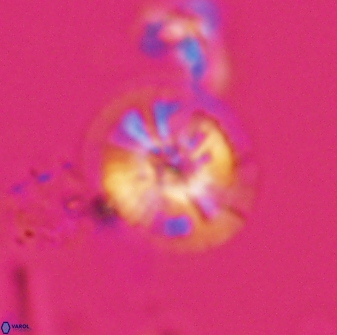 Calcidiscus cf pacificanus Unknown 00003