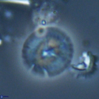 Calcidiscus cf pacificanus Unknown 00014