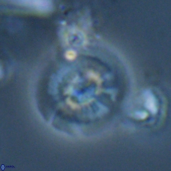 Calcidiscus cf pacificanus Unknown 00015