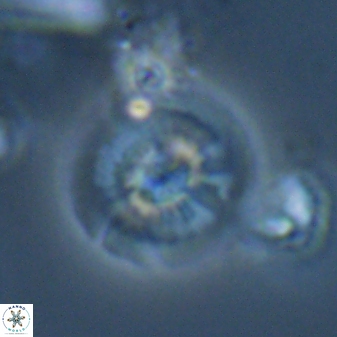 Calcidiscus cf pacificanus Unknown 00015