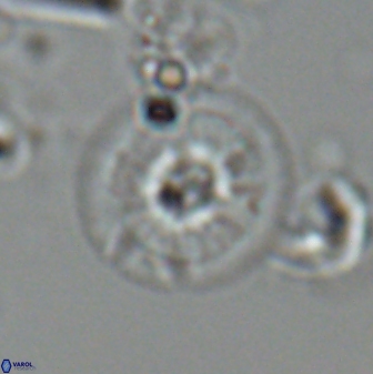 Calcidiscus cf pacificanus Unknown 00010