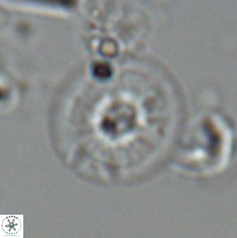 Calcidiscus cf pacificanus Unknown 00010