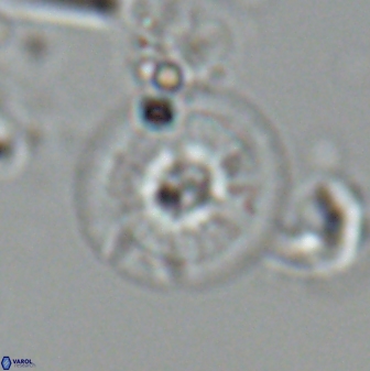 Calcidiscus cf pacificanus Unknown 00011