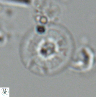 Calcidiscus cf pacificanus Unknown 00011