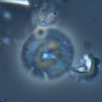 Calcidiscus cf pacificanus Unknown 00013