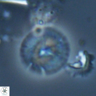 Calcidiscus cf pacificanus Unknown 00013