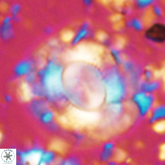 Calcidiscus gallagheri 14625