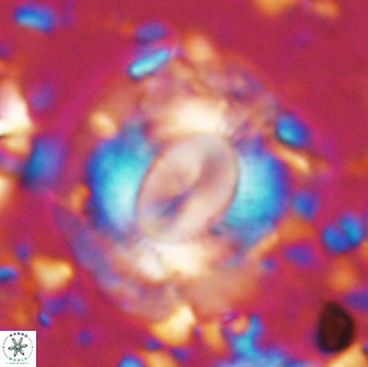Calcidiscus gallagheri 14629