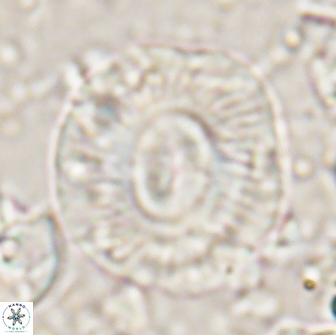 Calcidiscus gallagheri 14630