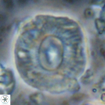 Calcidiscus gallagheri 14631