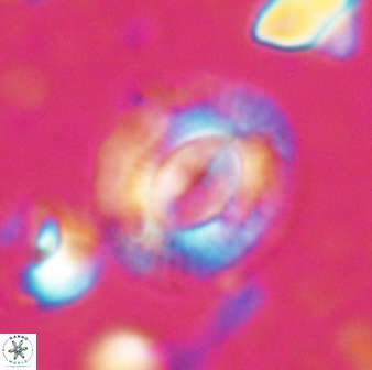 Calcidiscus gallagheri 28116