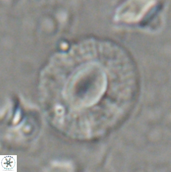 Calcidiscus gallagheri 28117