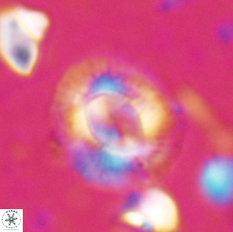 Calcidiscus gallagheri 28112