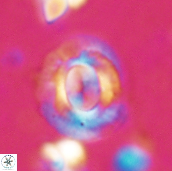 Calcidiscus gallagheri 28113