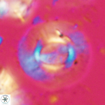 Calcidiscus gallagherii VR 028750