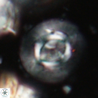 Calcidiscus gallagherii VR 028756
