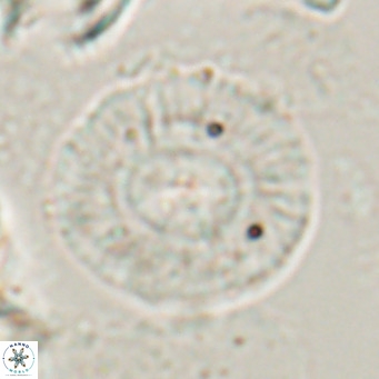 Calcidiscus gallagherii VR 028759