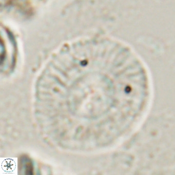Calcidiscus gallagherii VR 028760