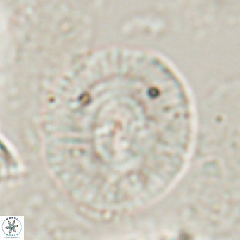 Calcidiscus gallagherii VR 028761