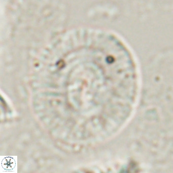 Calcidiscus gallagherii VR 028762