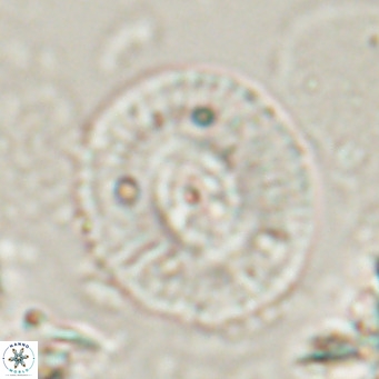 Calcidiscus gallagherii VR 028763