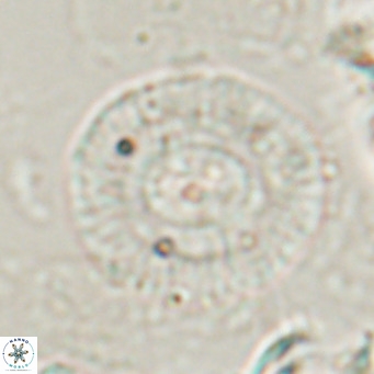 Calcidiscus gallagherii VR 028764