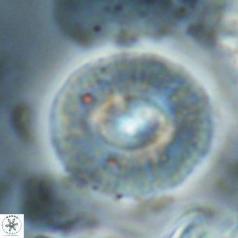 Calcidiscus gallagherii VR 028765
