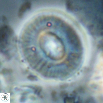 Calcidiscus gallagherii VR 028766