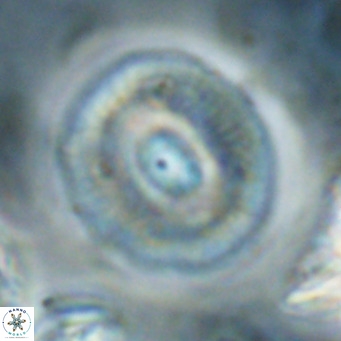Calcidiscus gallagherii VR 028767