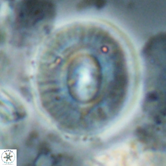 Calcidiscus gallagherii VR 028768