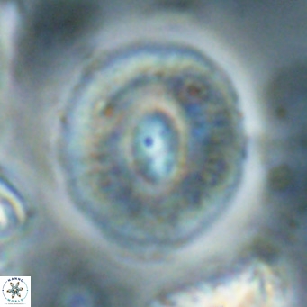 Calcidiscus gallagherii VR 028769